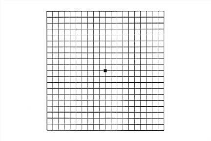 An Amsler Grid