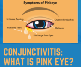 Symptoms of Conjunctivitis