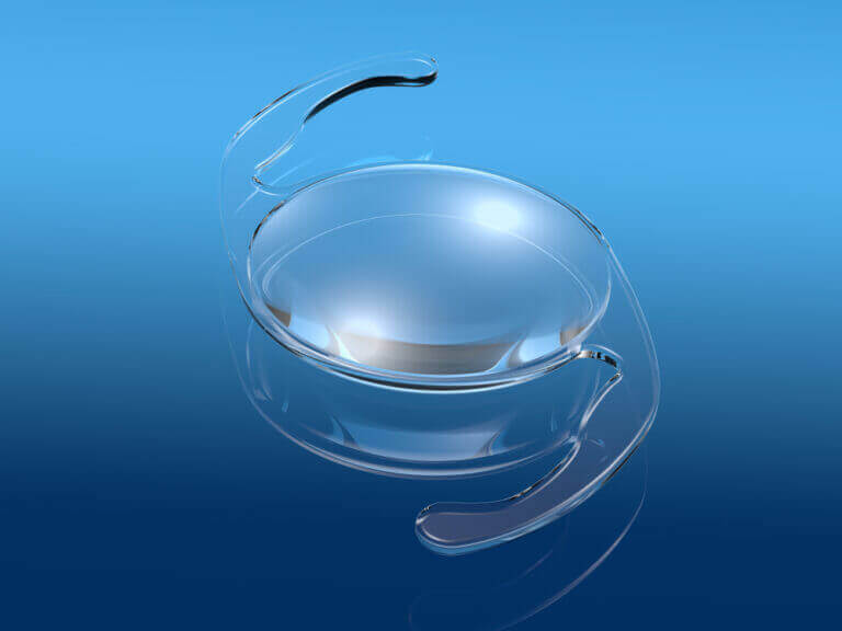 Alcon blue lens for catarac surgery darken vision accenture job openings